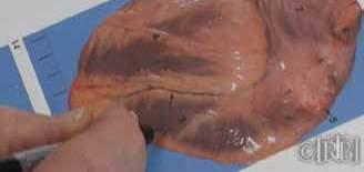 An image of a human heart with markings indicating areas of interest or injury.