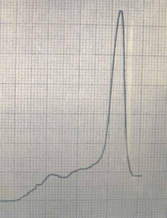 A graph showing the electrophoresis results of the proteins from the Blood of the Miracle.