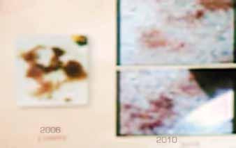 The image shows two microscopic images of blood samples from 2006 and 2010.
