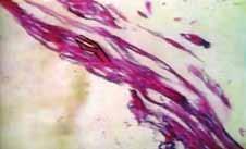 Microscopic image showing tissue structure related to the Eucharistic Miracle.