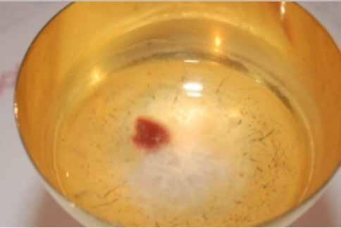An image showing a stained Host in a golden chalice.