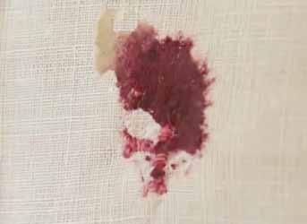 A close-up image of a red stain resembling blood on a white cloth.